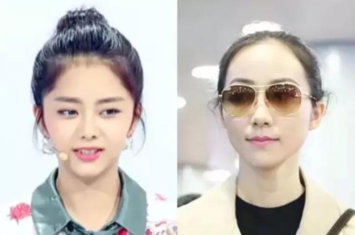 脸大怎么办自救方法,颅顶低的女生拯救办法