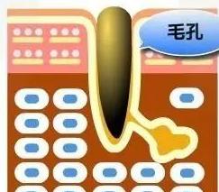 毛孔粗大原因及如何改善,突然毛孔粗大是什么原因