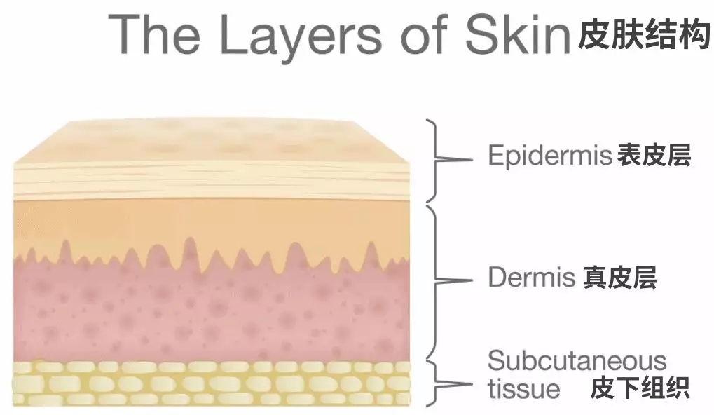 聊聊伤疤的故事,聊聊瘢痕问题