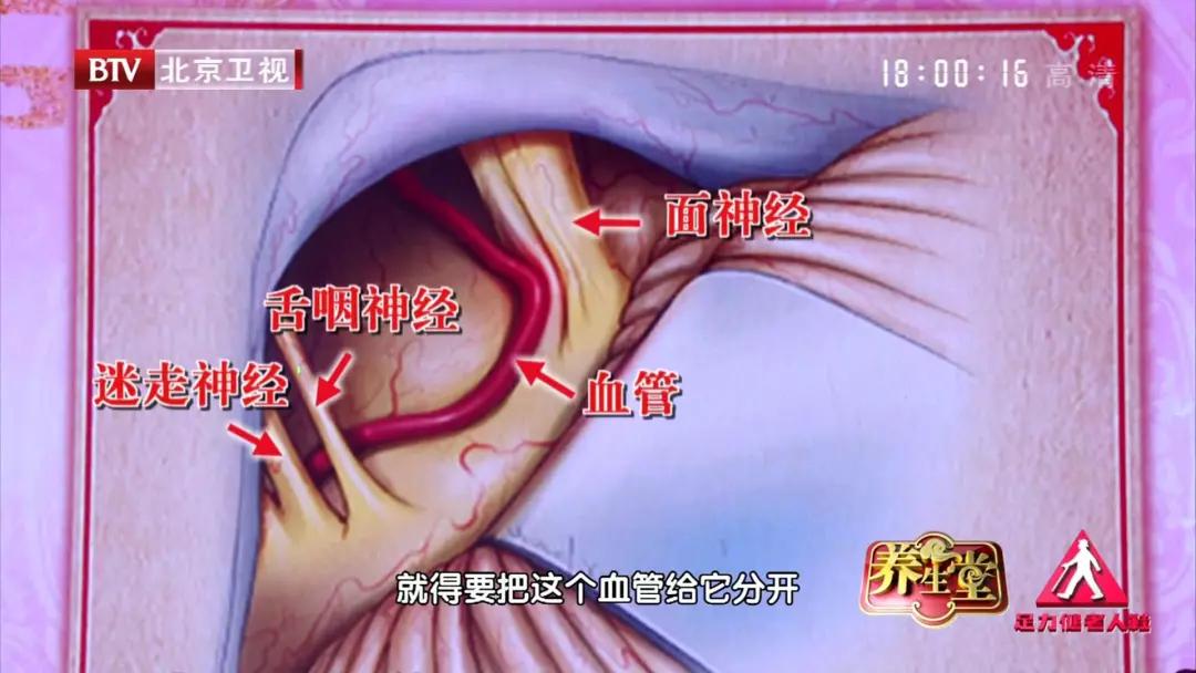 眼皮跳财运到?当心是一种特殊高血压!专家:用一块棉垫就能治愈