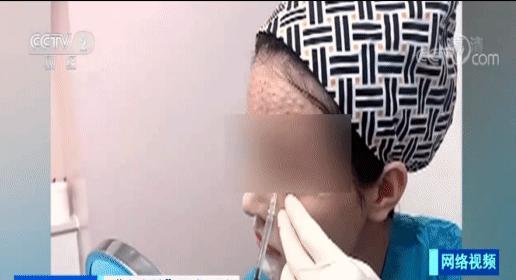 水光针水货跟假货的区别,央视点评水光针