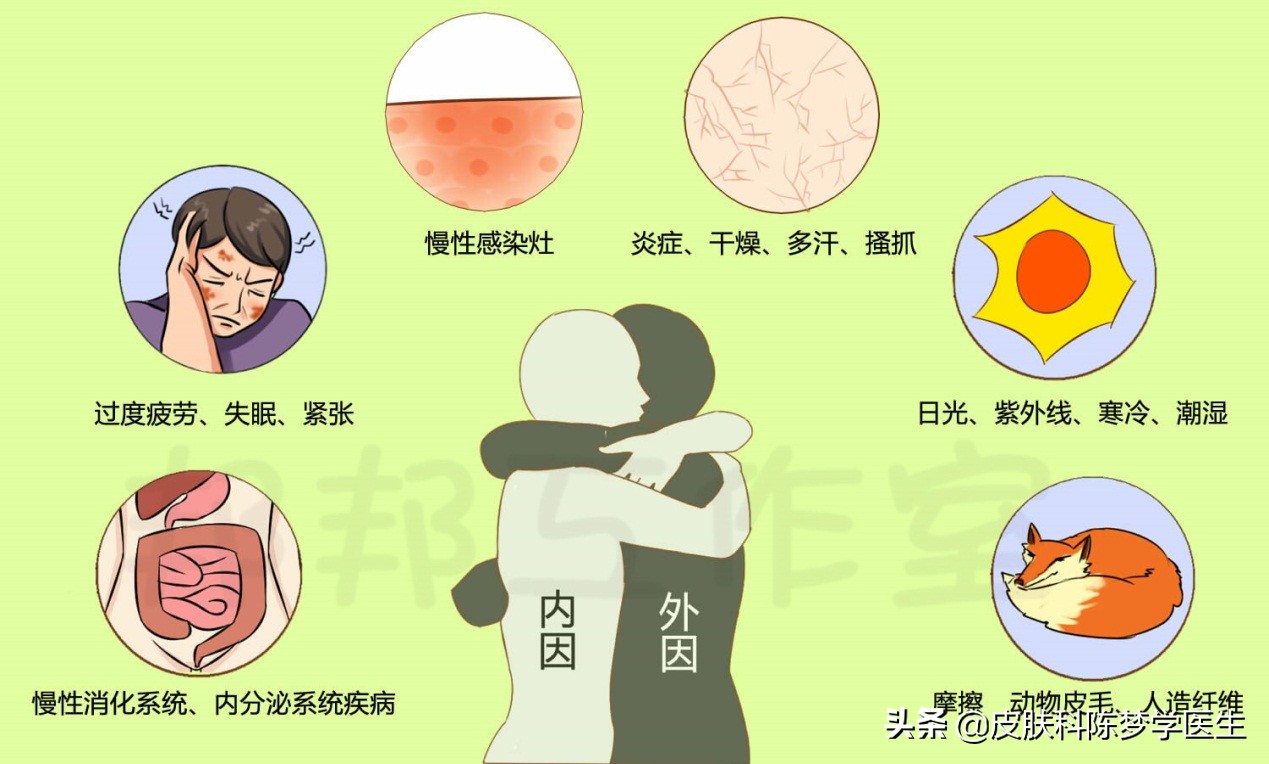 湿疹全身痒住院怎么检查治疗,湿疹红肿痒痒怎么治疗效果好