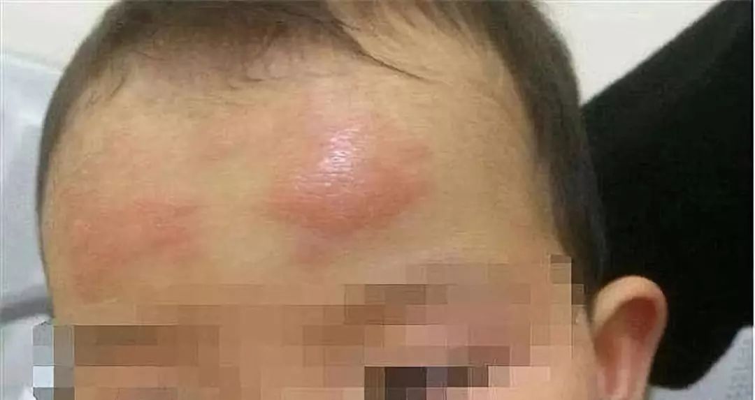 德州小儿退烧贴,退热贴德州