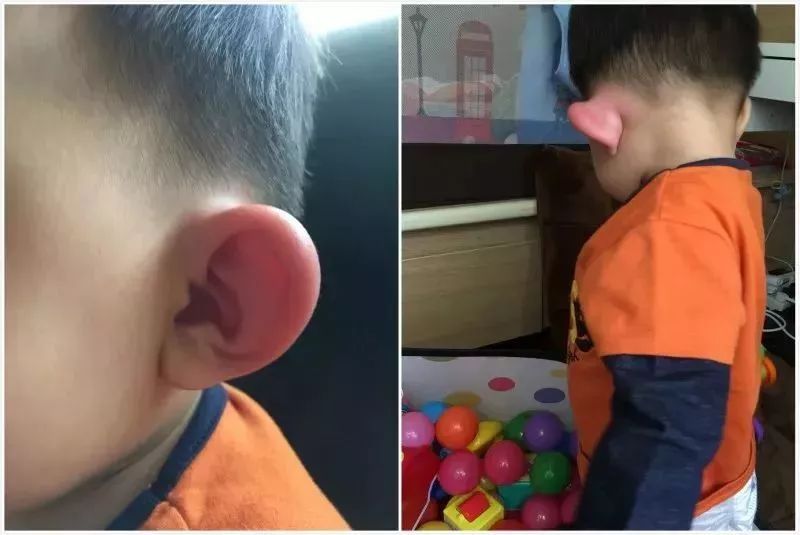 被蚊子咬了是直接拍死还是赶走,被蚊子咬后该干什么