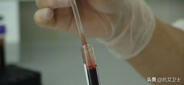 癌症患者人文关怀,癌症晚期每个人都要重视吗