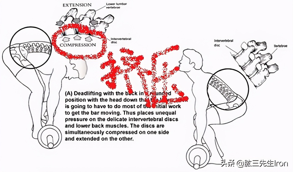 腰部受伤了怎么恢复训练,腰部受伤最佳恢复方法