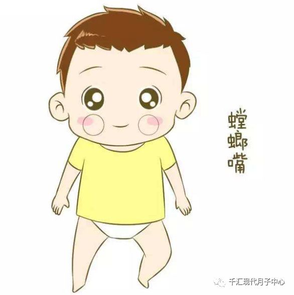 新生儿为什么会有马牙和螳螂嘴,新生儿长的马牙螳螂嘴要不要治