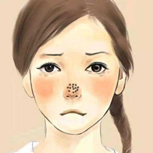 去黑头的最好方法医生建议,皮肤科医生手把手教你解决黑头