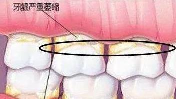 急急如律令哪吒完整版咒语,哪吒之魔童降世急急如律令口诀