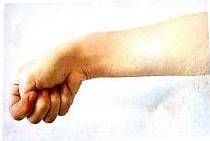 几个动作预防腱鞘炎（妈妈手），准妈妈必看