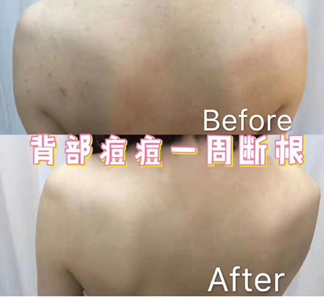 100块钱能买最多护肤品,现在可以买哪些品牌的护肤品