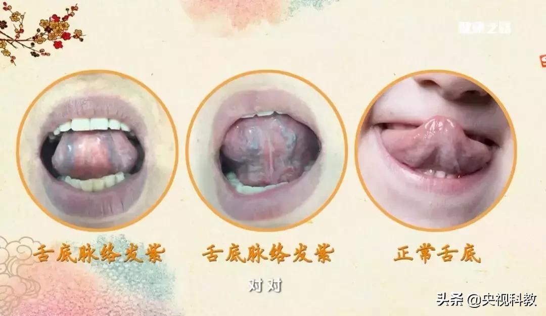 去除肌瘤囊肿中药,身上长结节息肉肌瘤怎么治