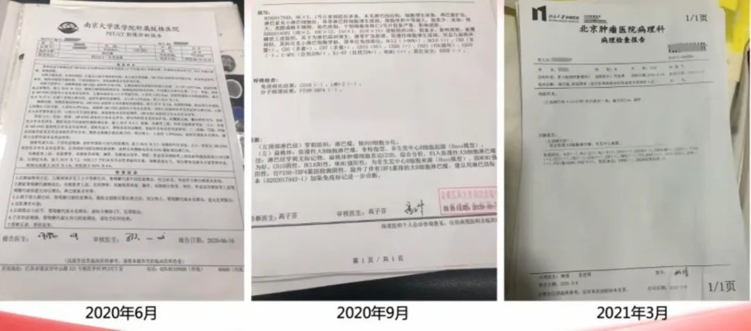 确诊淋巴瘤的最可靠依据是什么,我的淋巴瘤是遗传的能治好吗