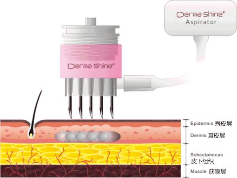 90%的皮肤问题都是缺水导致的,每天8杯水补水
