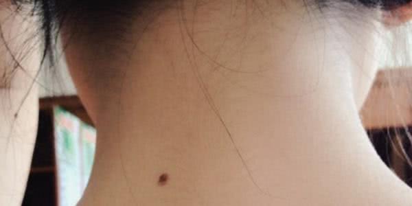 为什么有些人脖子下面有一条线,为什么有的人脖子长汗毛