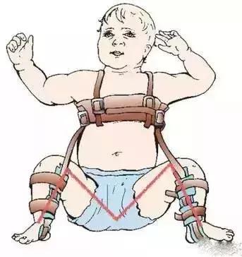 婴儿背带腰凳好还是不带腰凳好,腰凳和背带哪个对宝宝比较舒适