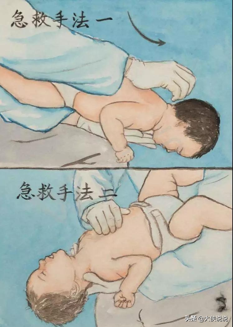 小孩吞入异物一般掉落到哪儿,吞入异物自救法