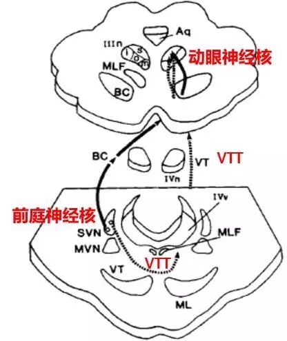 上跳性眼震能自愈吗,位置性眼震及眩晕