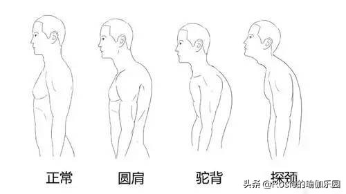 脖子前倾轻微驼背穿搭,脖子前倾体态不好怎么改善