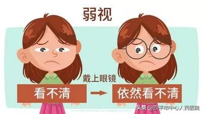 四平市中心人民医院视光中心儿童弱视公益行