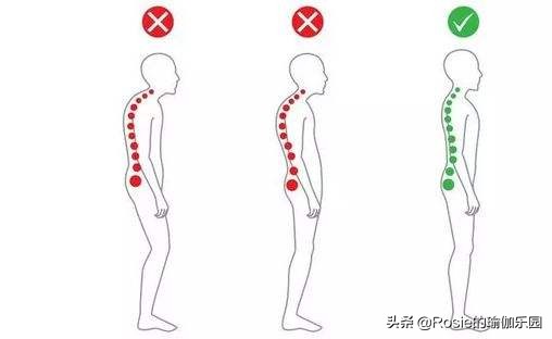 “翘臀”还有假?先自测再确认:你是真“翘臀”还是骨盆前倾?