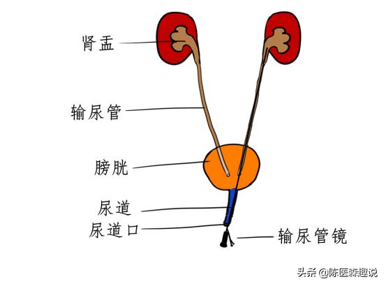 发现肾结石怎样治疗更好,发现肾结石怎么办