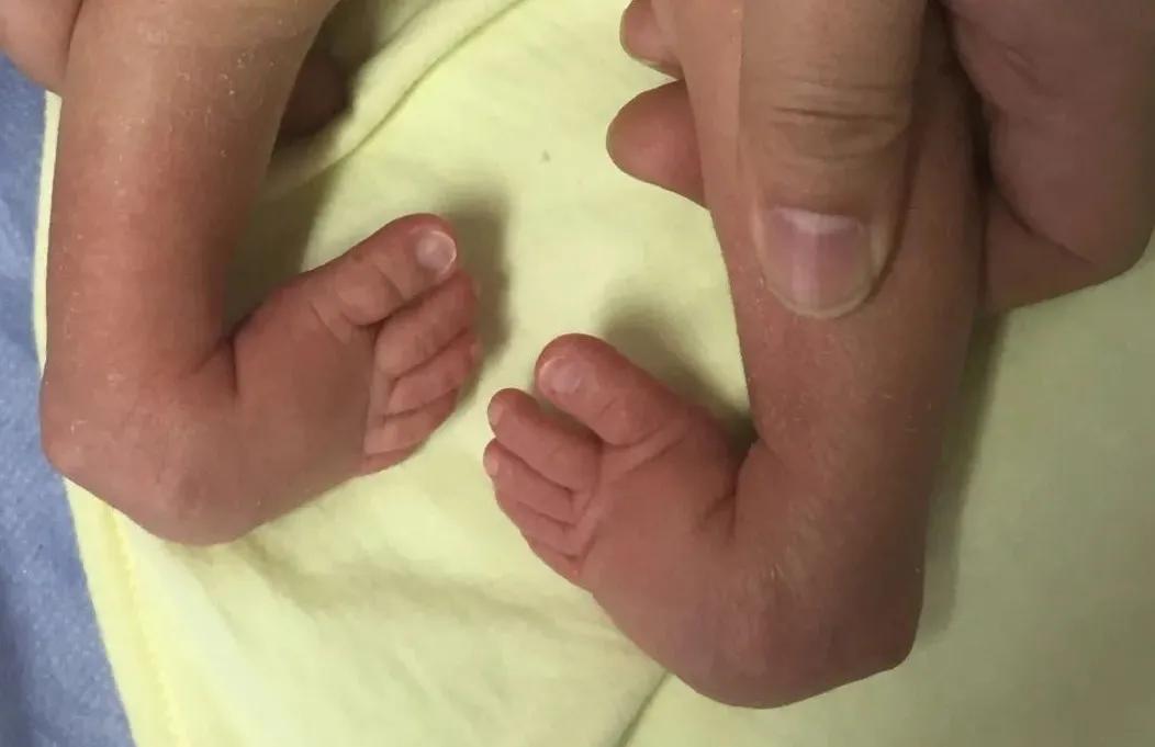 带您了解不一样的小儿骨科,小儿骨科医生在线问诊