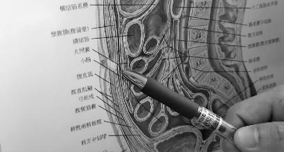 洗肚脐问题让夫妻吵了一架看看医生是怎么说的