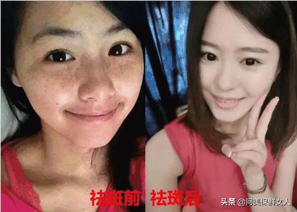 祛斑真实案例内调,祛斑案例说说