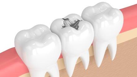 疫情期间口腔科普小知识,口腔急救知识