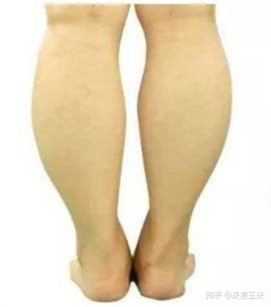 假胯宽、大象腿、脂肪腿,天生大粗腿的人该如何瘦大腿?