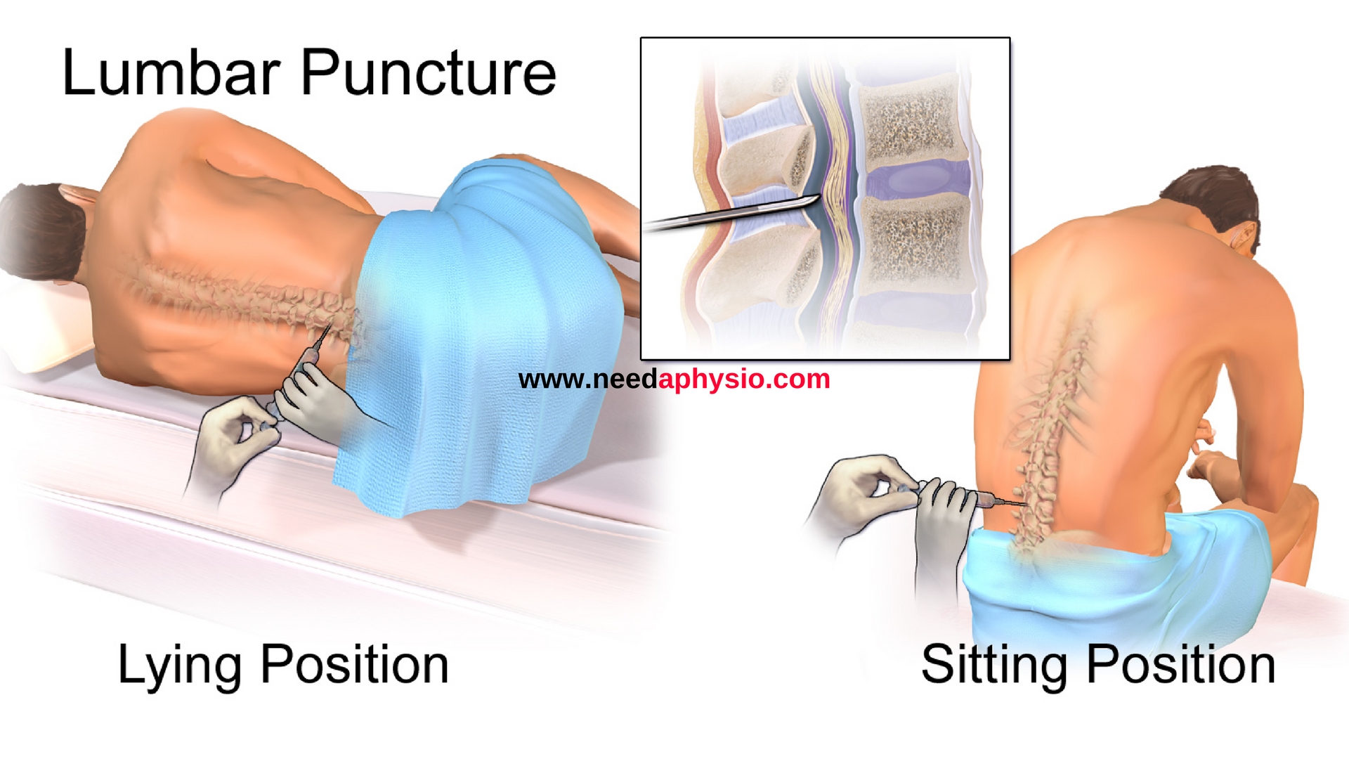 阴道窥器使用实验报告,阴道仪器治疗漏尿中老人有用吗