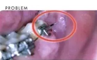 非常时期保护自己避开毒,非常时期是危机还是转机