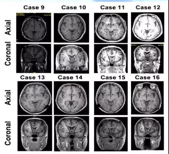 高国栋现在在哪坐诊,高国栋谈戒毒视频