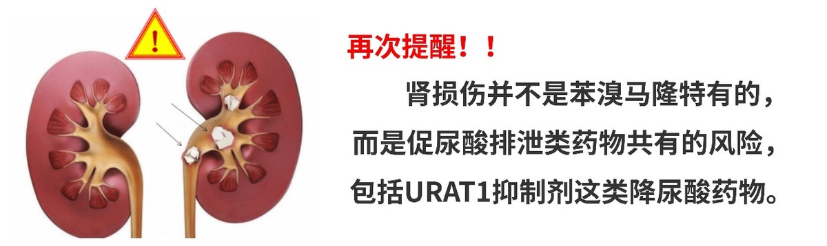 纳德类会爆雷吗？