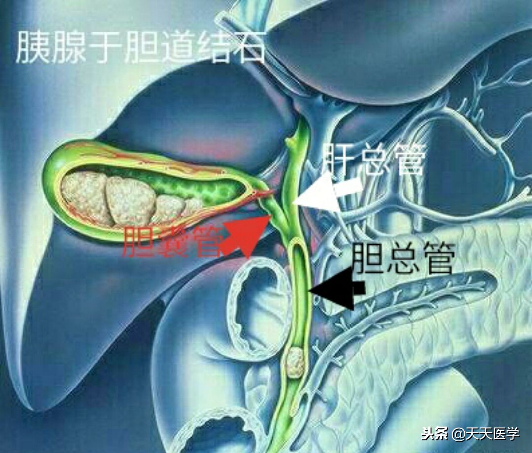 腹腔镜胆囊切除术后饮食护理问题,腹腔镜胆囊切除术后护理注意事项