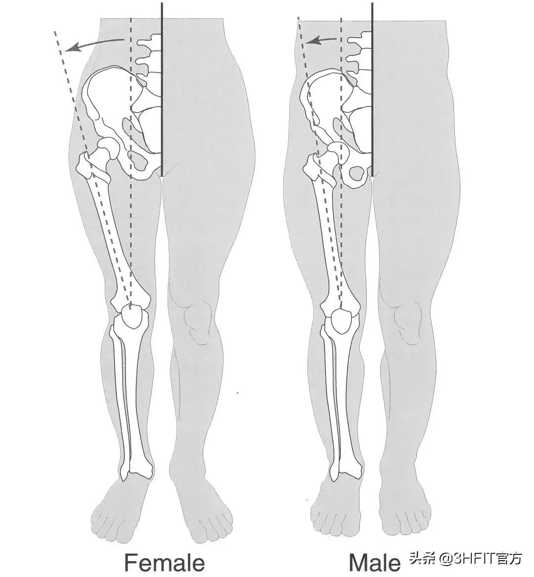 女性膝关节疼痛的最好治疗方法,为什么女性膝关节更容易出问题