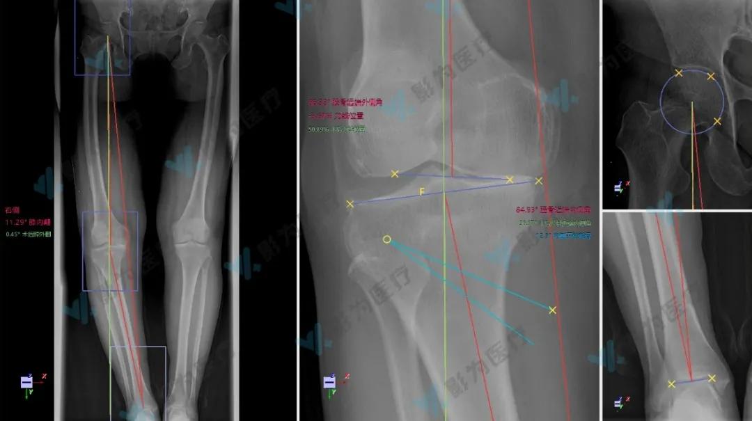安医大阜阳附属医院减重,阜阳市颍州区安医大附属阜阳医院