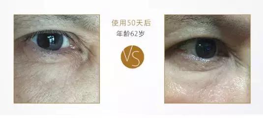 有了前法国第一夫人的百元“黑科技”眼霜,我把3000块眼霜扔了!