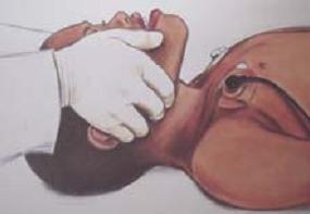 心肺复苏胸外按压的正确部位,电工考试心肺复苏的正确步骤