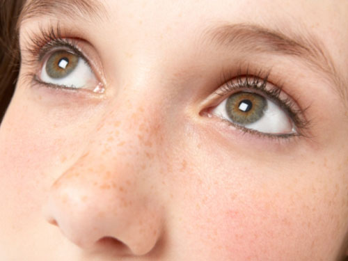 脸上有蝴蝶斑怎么调理淡化色斑,脸上有好多蝴蝶斑怎么治呀