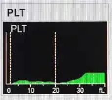 红细胞聚集指数偏高会引起血栓吗,红细胞分布宽度与血栓的关系