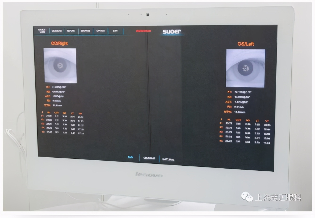 ok镜复查眼轴要停戴吗,ok镜复查需要做哪些项目