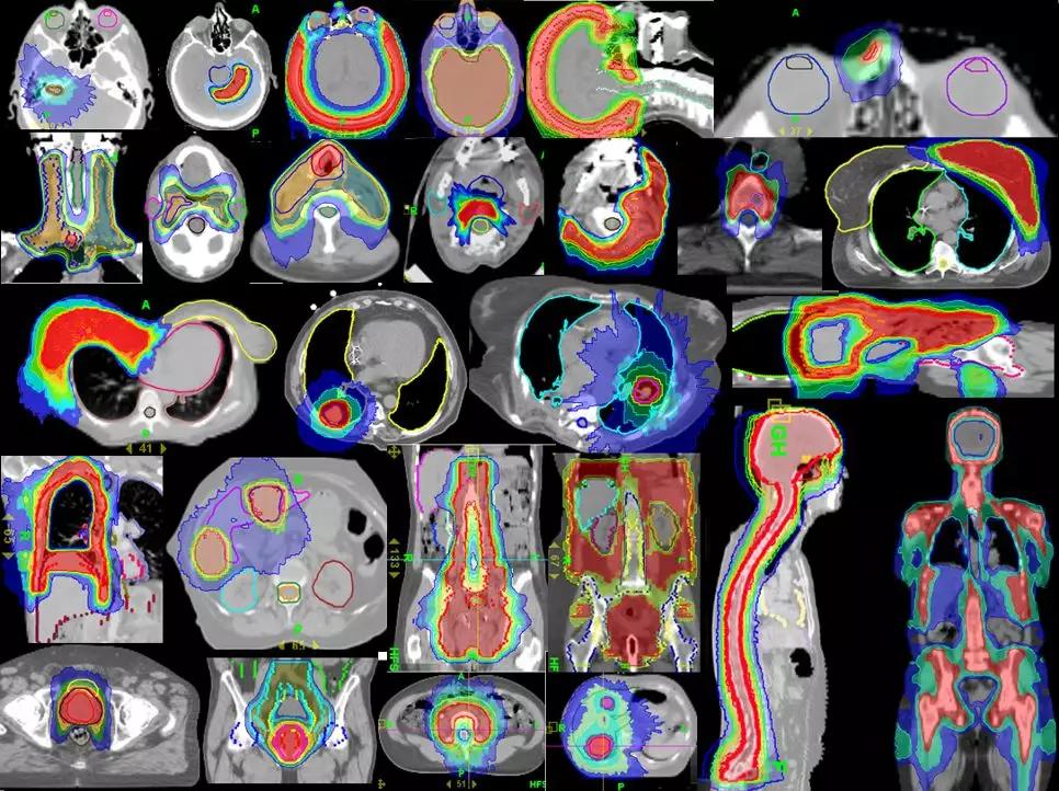制定最适合肿瘤患者的抗癌方案,2021年肿瘤治疗指南