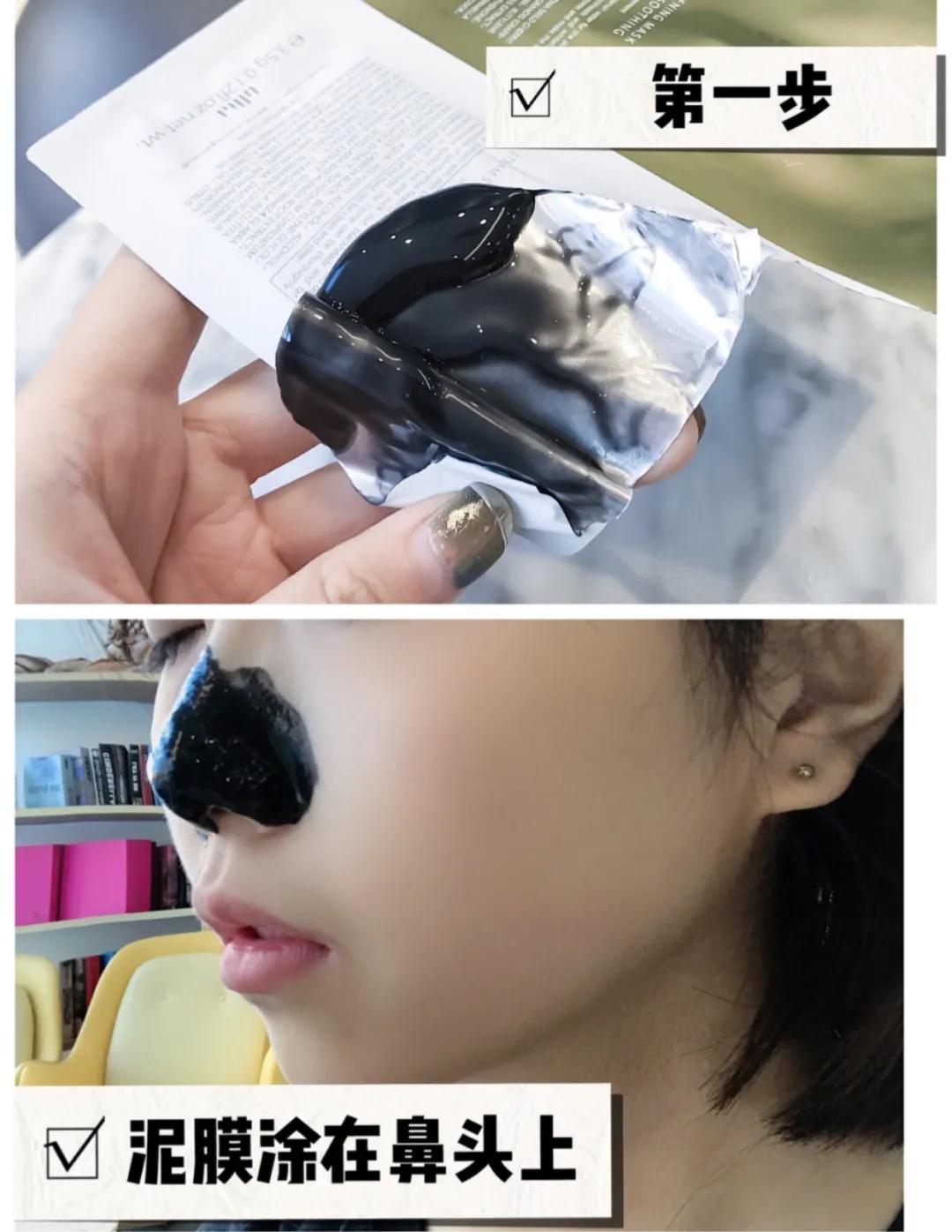 亲测真正有效去黑头粉刺产品,黑头连根拔起还会再长吗