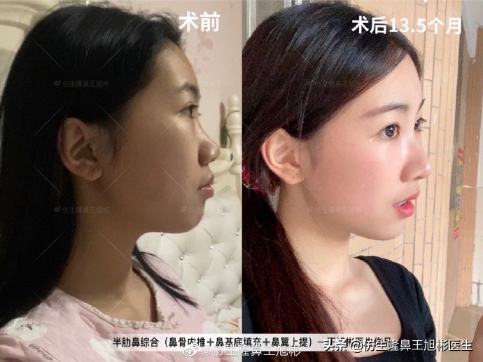 被鼻子封印的颜值,那些被鼻子封印的颜值