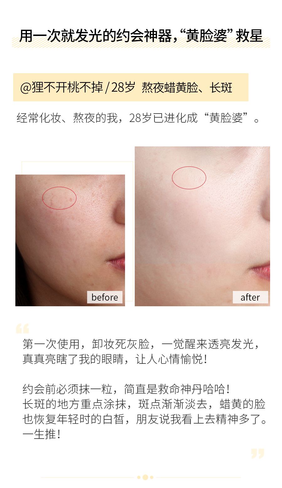 琚佸濮楁帹鑽愯憽钀勭苯鎶よ偆,琚佸濮楄憽钀勭苯绮惧崕