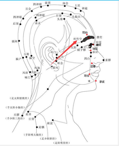 视神经萎缩针灸可以提高视力吗,视神经萎缩针灸部位图解