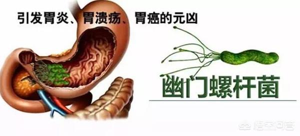 胃病怎么养胃是最好的方法,有胃病的人如何在日常生活中养胃