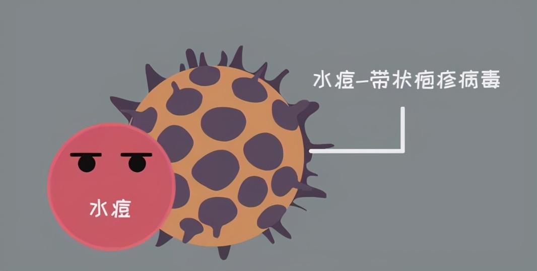 哪些人容易得令人痛苦不堪的“带状疱疹”？